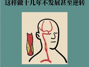 颈动脉斑块必须吃他汀？这样做十几年不发展甚至逆转
